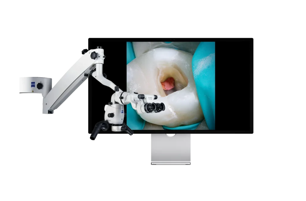Лечение зубов под микросокопом