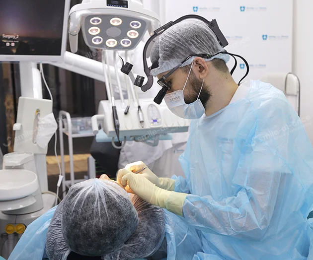 Установка имплантов по хирургическим шаблонам