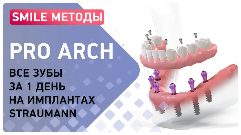 Технология Pro Arch все зубы за 3 дня на имплантах Straumann