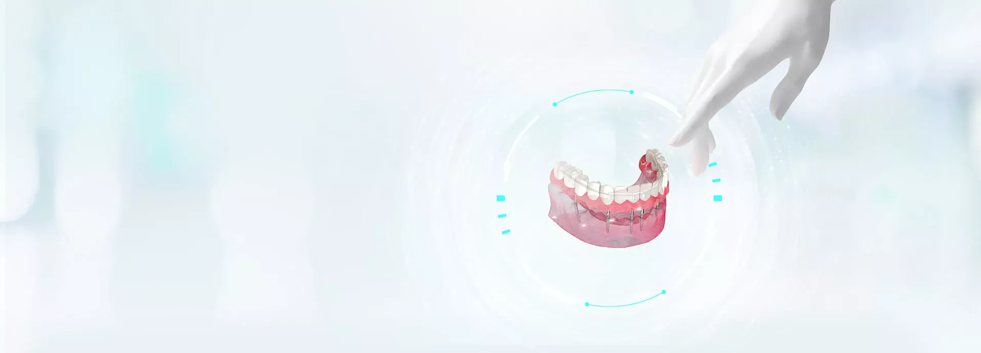 Установка зубных имплантов Neodent