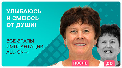 Видео - Имплантация all-on-4 бесплатно: итоги лечения Татьяны Лавриненко