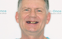 Противопоказания имплантации зубов пародонтит