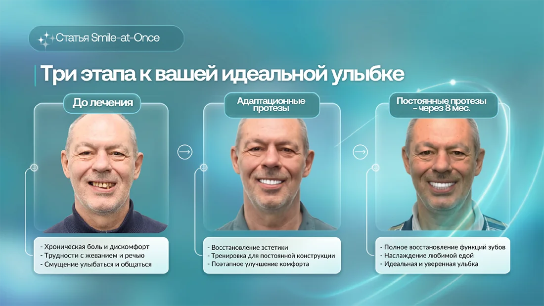 Этапы восстановления зубов