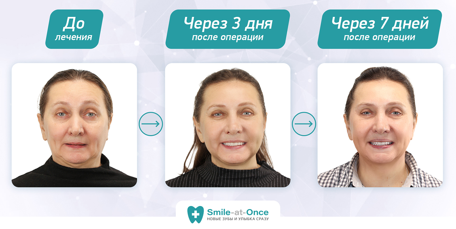 Победитель социальной акции Трансформация улыбка Татьяна Антропова