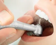 Профессиональная гигиена полости рта