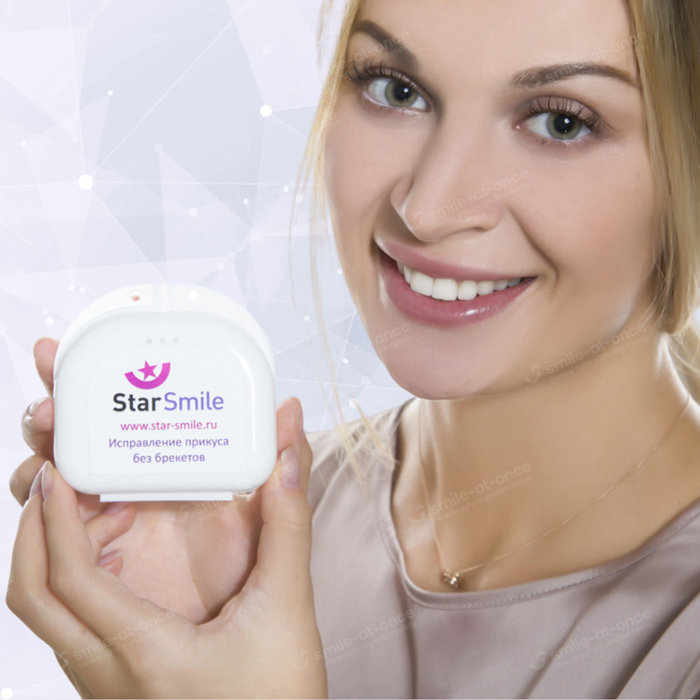 Применение элайнеров Star Smile для исправления прикуса Элайнеры Star Smile