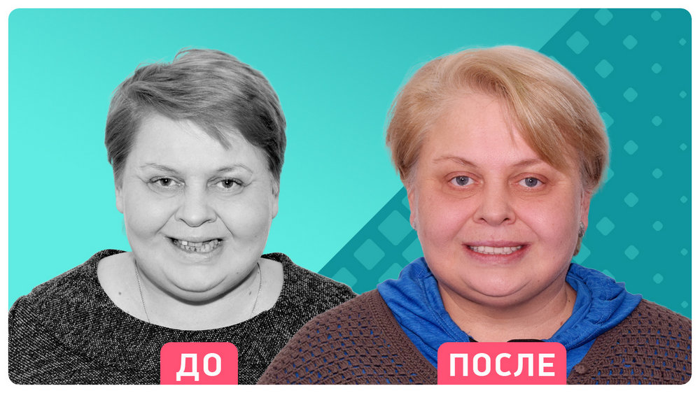 Победитель акции Трансформация Улыбки 2018