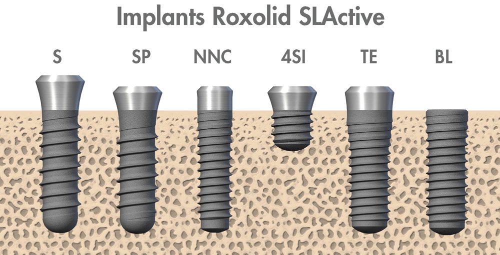 Импланты какие фирмы. Импланты Straumann ROXOLID. Система Штрауман импланты. Импланты Штрауман 4.4 мм. Имплантаты Straumann (Штрауман).
