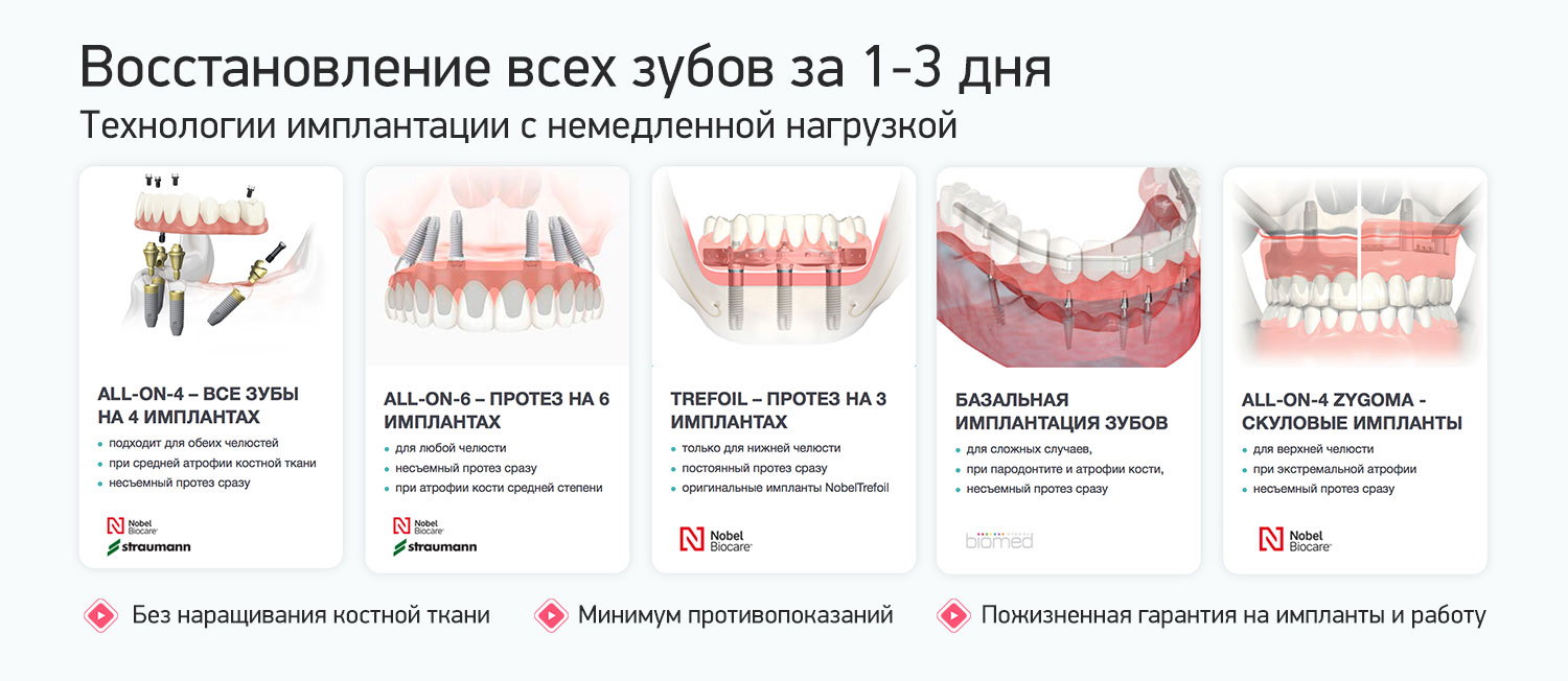 Применяемые технологии имплантации зубов