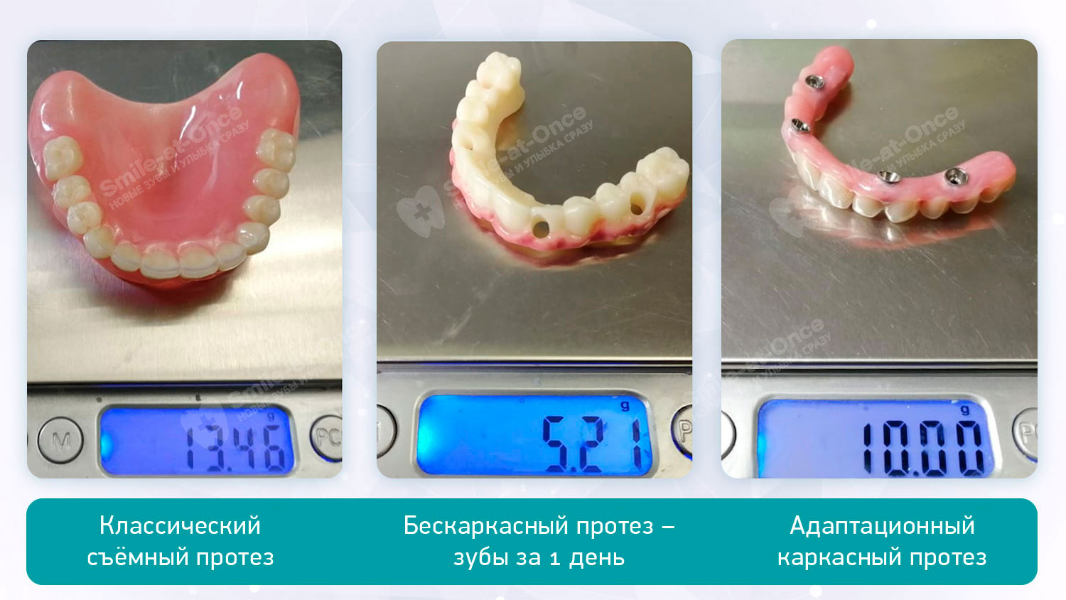Сравнение веса зубных протезов