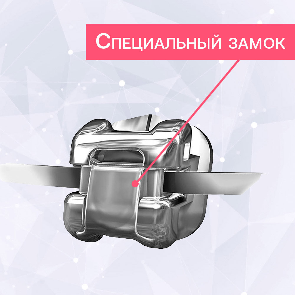 Замок на металлических брекетах