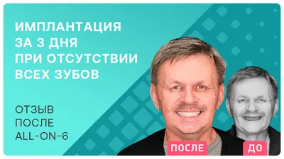 Видео - Что делать, если нет всех зубов? Имплантация all-on-6 за 3 дня