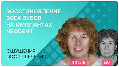 Видео - Отзыв пациентки после восстановления всех зубов на имплантах