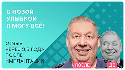 Видео - Подробный отзыв через 3,5 года после имплантации всех зубов