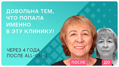 Видео - Все этапы all-on-4 – как проходит восстановление зубов за 3 дня