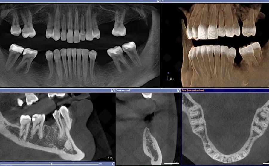 Индивидуальная форма зубов у людей