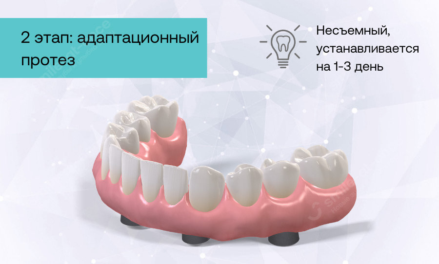 Второй этап имплантации зубов