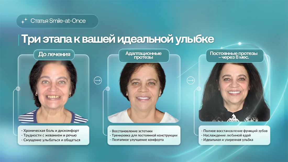 Этапы изменения внешности после имплантации зубов