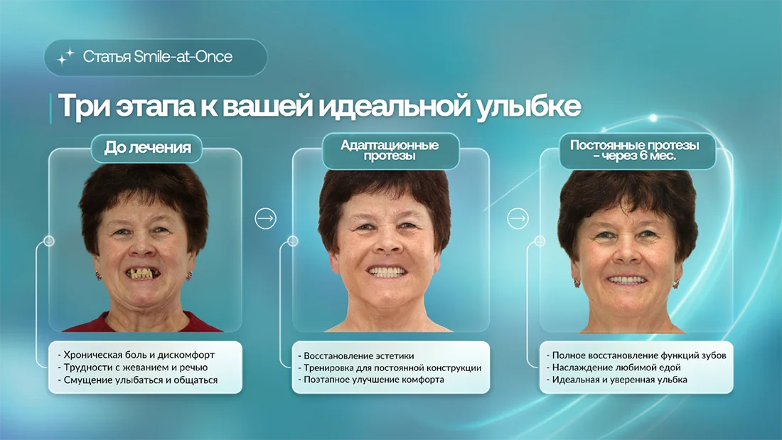 Изменения внешности после имплантации зубов