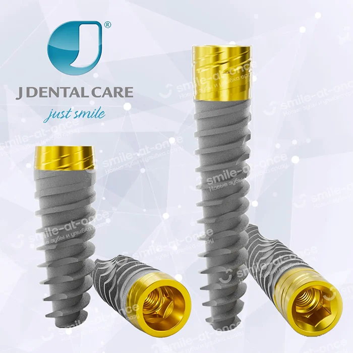 Зубные импланты JDentalCare