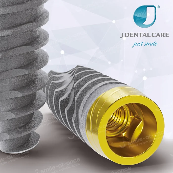 Особенности и преимущества имплантов JDentalCare