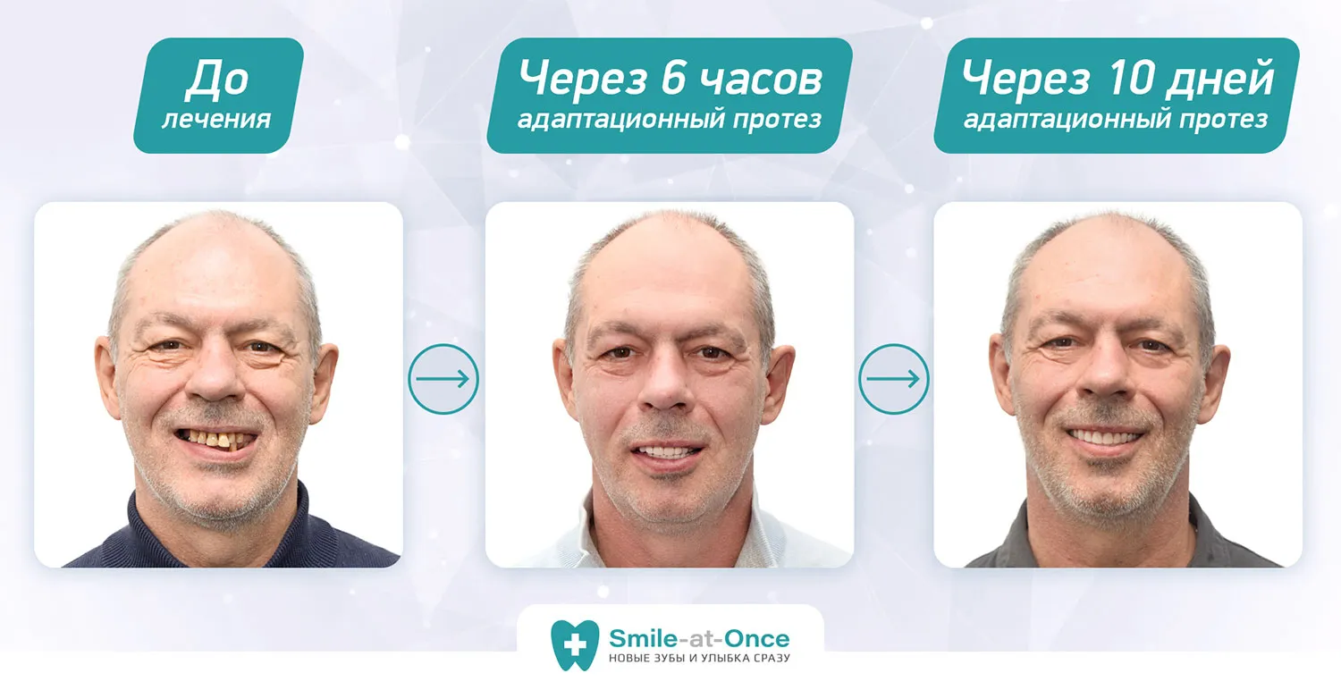 Победитель социальной акции Трансформация улыбка Игоря