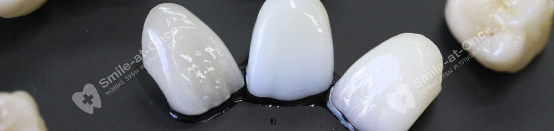 Керамические зубные протезы