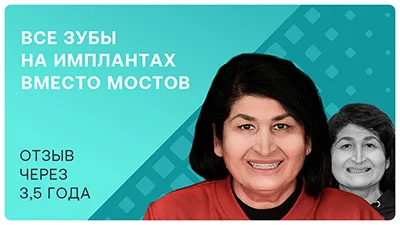 Видео - Все зубы на имплантах вместо неудобных мостов