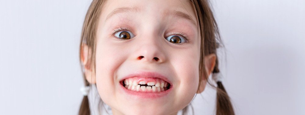 Молочные зубы играют важную роль в развитии ребенка