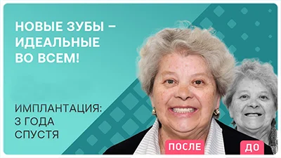 Видео - Комплексная имплантация зубов в 70 лет: отзыв 3 года спустя