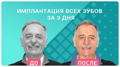 Видео - Индивидуальный подход для каждого: отзыв пациента через 2 года