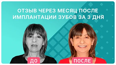 Видео - Отзыв пациентки спустя месяц после имплантации зубов за 3 дня