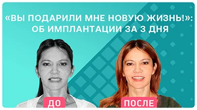 Видео - «Вы подарили мне новую жизнь!»: пациентка из Сибири об имплантации за 3 дня