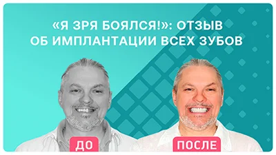 Видео - «Я зря боялся!»: отзыв пациента об имплантации за 3 дня