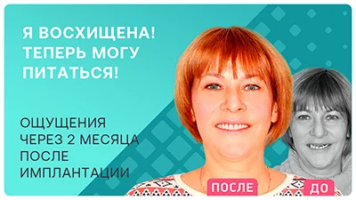 Видео - Итоги «Трансформации улыбки»: преображение Ольги Пыховой после имплантации зубов