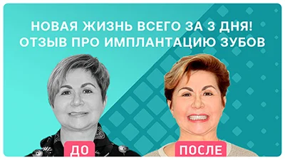 Видео - Новая жизнь всего за 3 дня! Подробно об имплантации с немедленной нагрузкой