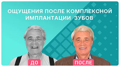 Видео - Отзыв о комплексной имплантации нижних зубов на фоне острой атрофии