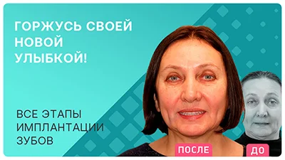 Видео - Комплексная имплантация бесплатно: итоги лечения Татьяны Антроповой