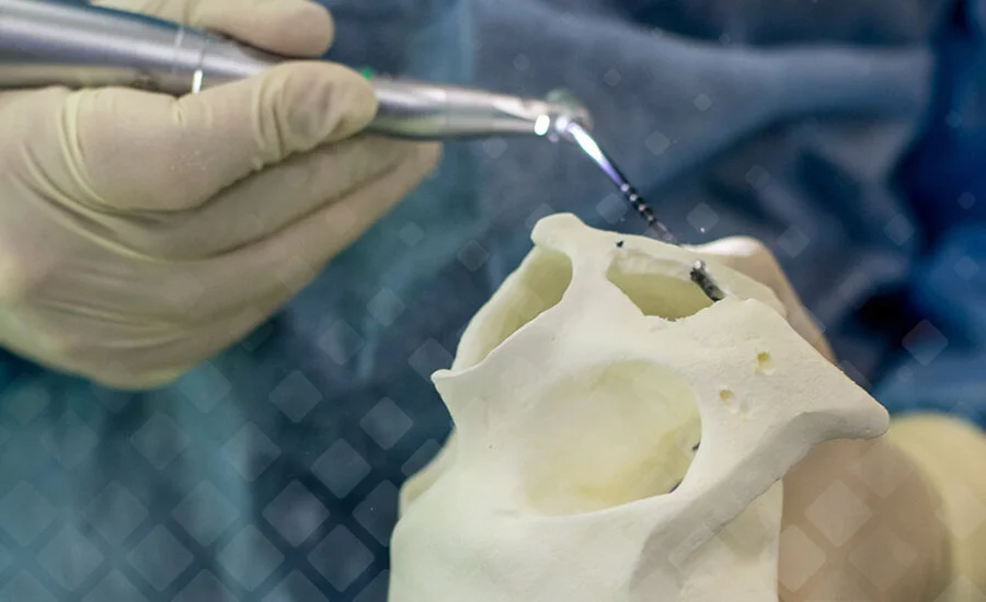 Обучение хирургов стоматологов установке скуловых зубных имплантов