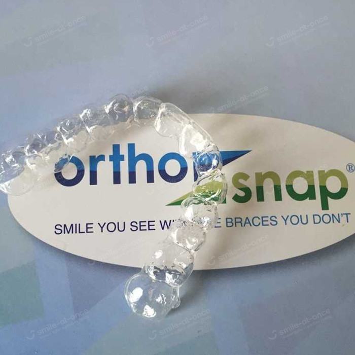 Внешний вид элайнеров Ortho Snap Элайнеры Ortho Snap