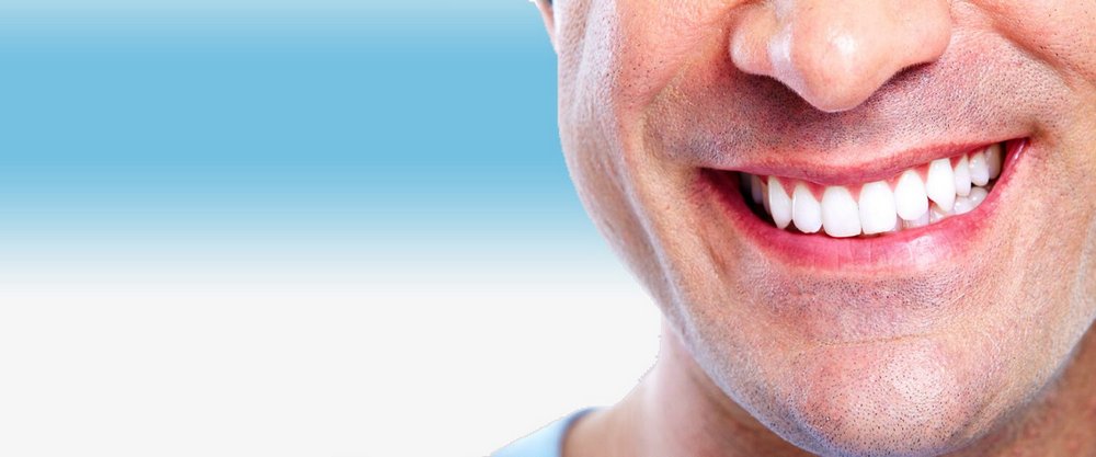 Вопросы по отбеливанию зубов
