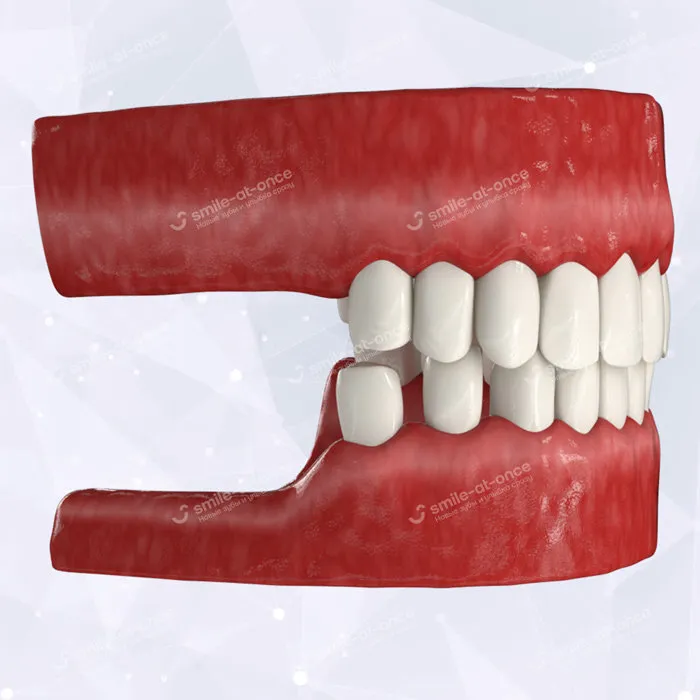 Негативные последствия отсутствия жевательных зубов