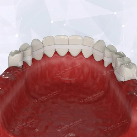 Подвижность зубов и их причины