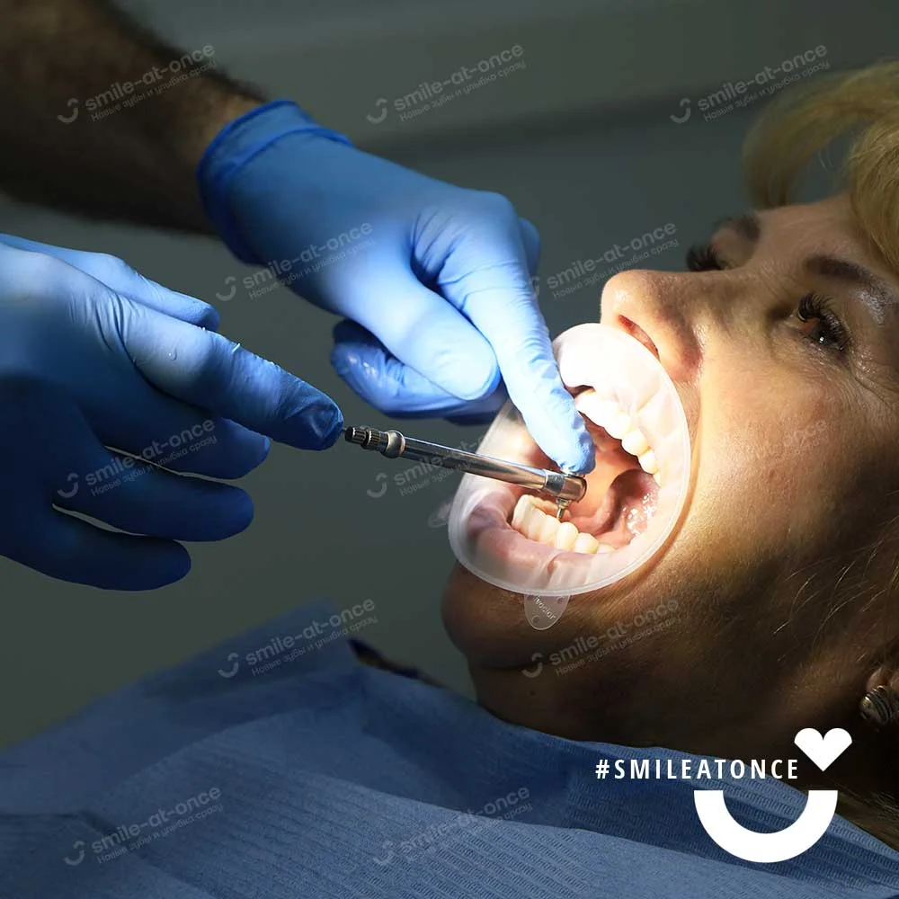 Фото после установки зубных протезов