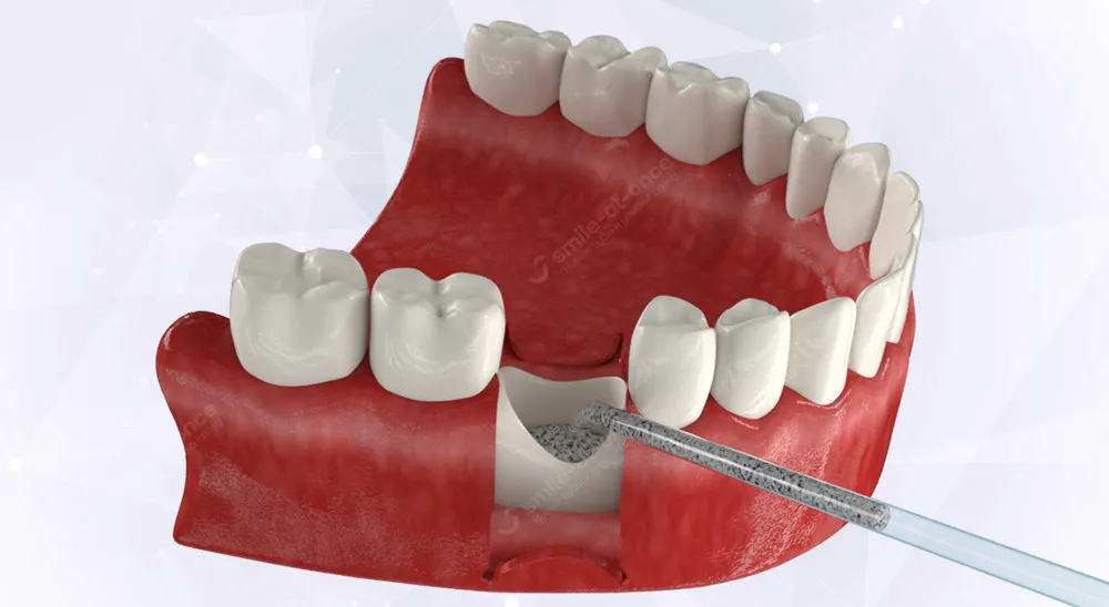 Идет кровь из зуба: причины и способы лечения