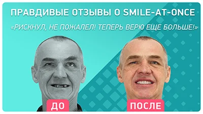 Видео - Подробный отзыв о Smile-at-Once и этапах комплексной имплантации зубов