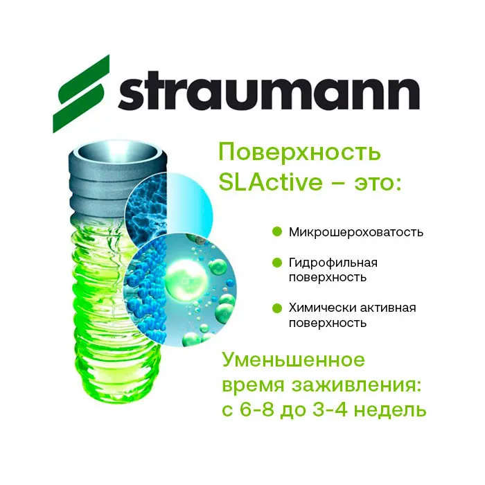 Преимущества имплантации Straumann
