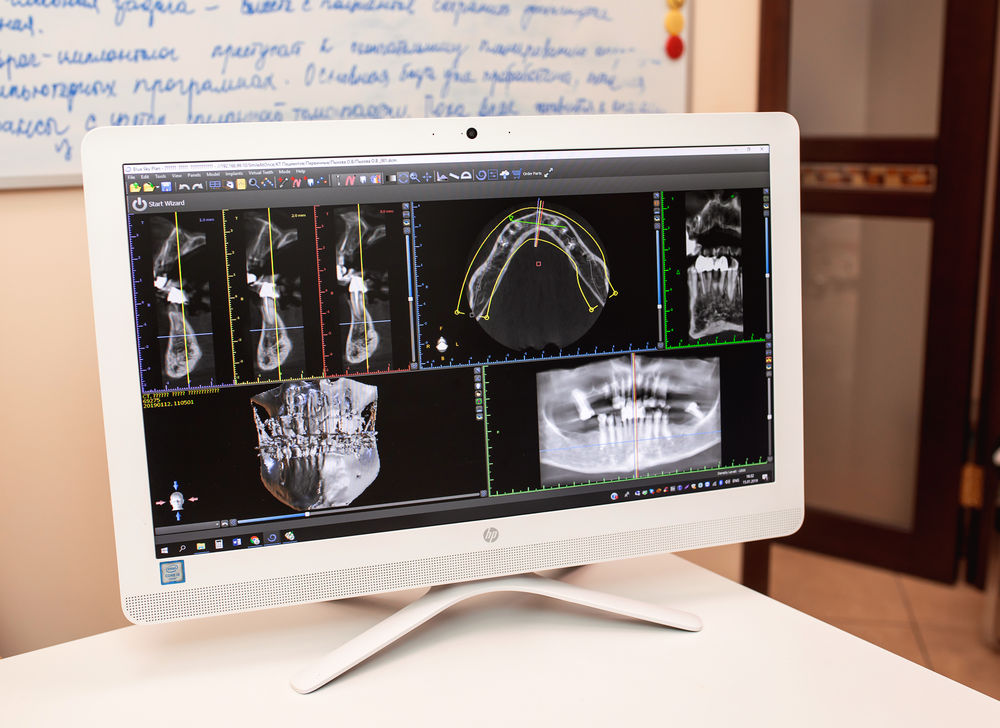 Программное обеспечение для 3D-планирования процесса лечения