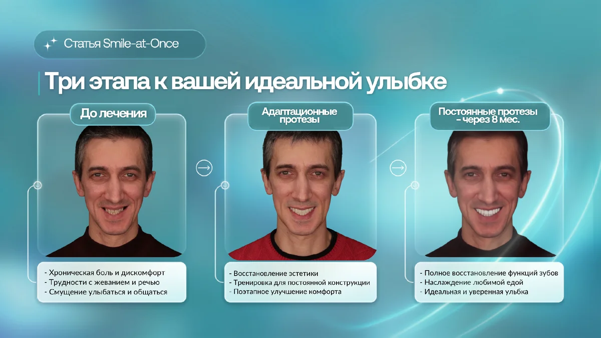 Три стадии обречения новой улыбки