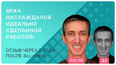Видео - Новая улыбка за 1 день и навсегда! Этапы имплантации Pro Arch от Straumann